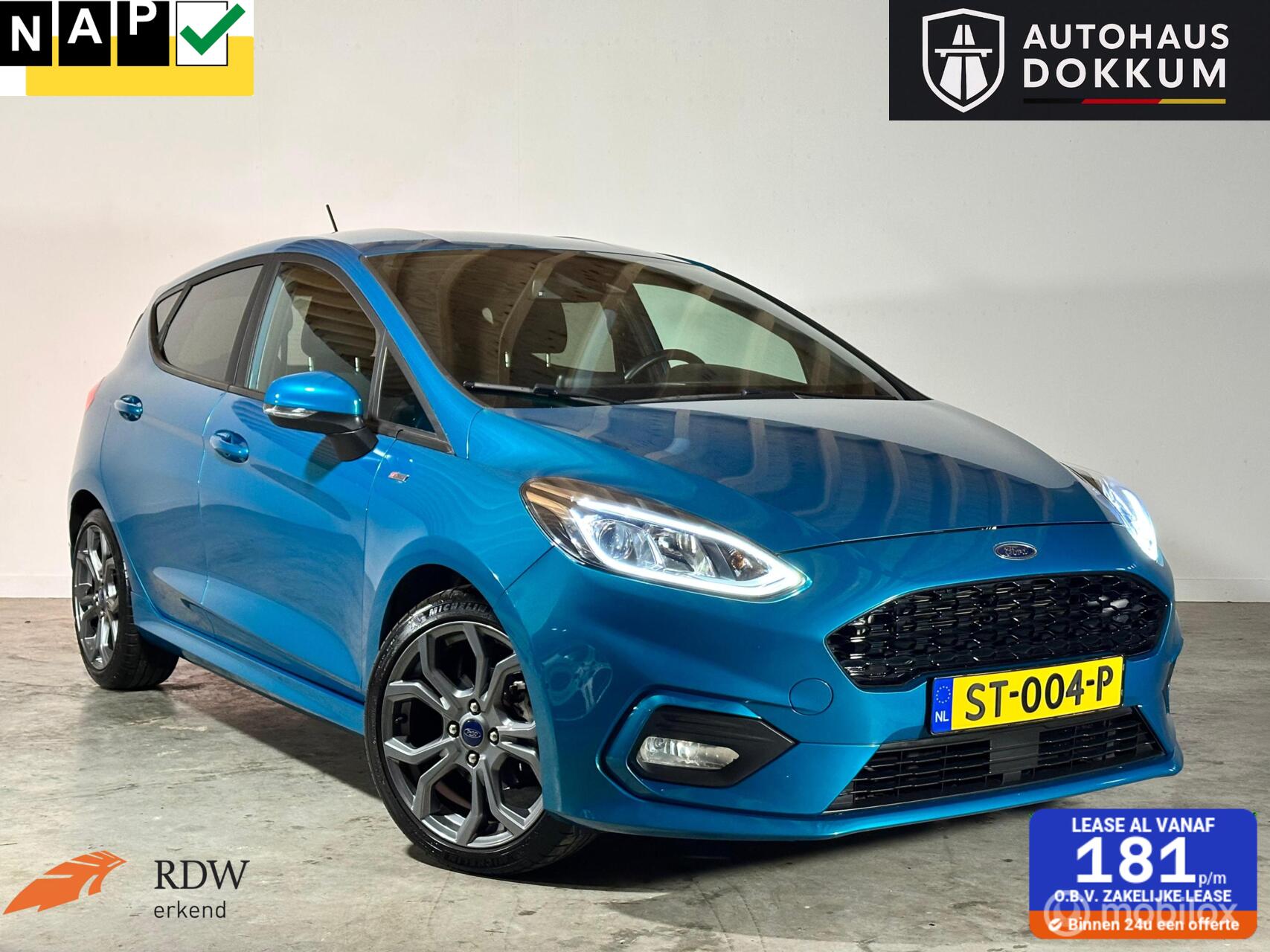 Ford Fiesta 1.0 EcoBoost ST-Line Stoelverw / Stuurverw / PDC 2018 - voorkant