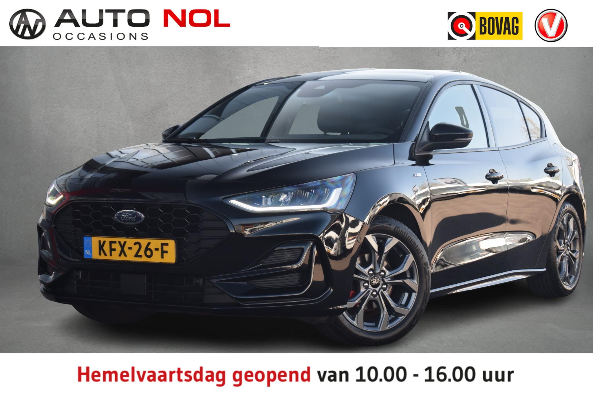 Ford Focus 1.0 EcoBoost Hybrid ST Line X 2024 - voorkant