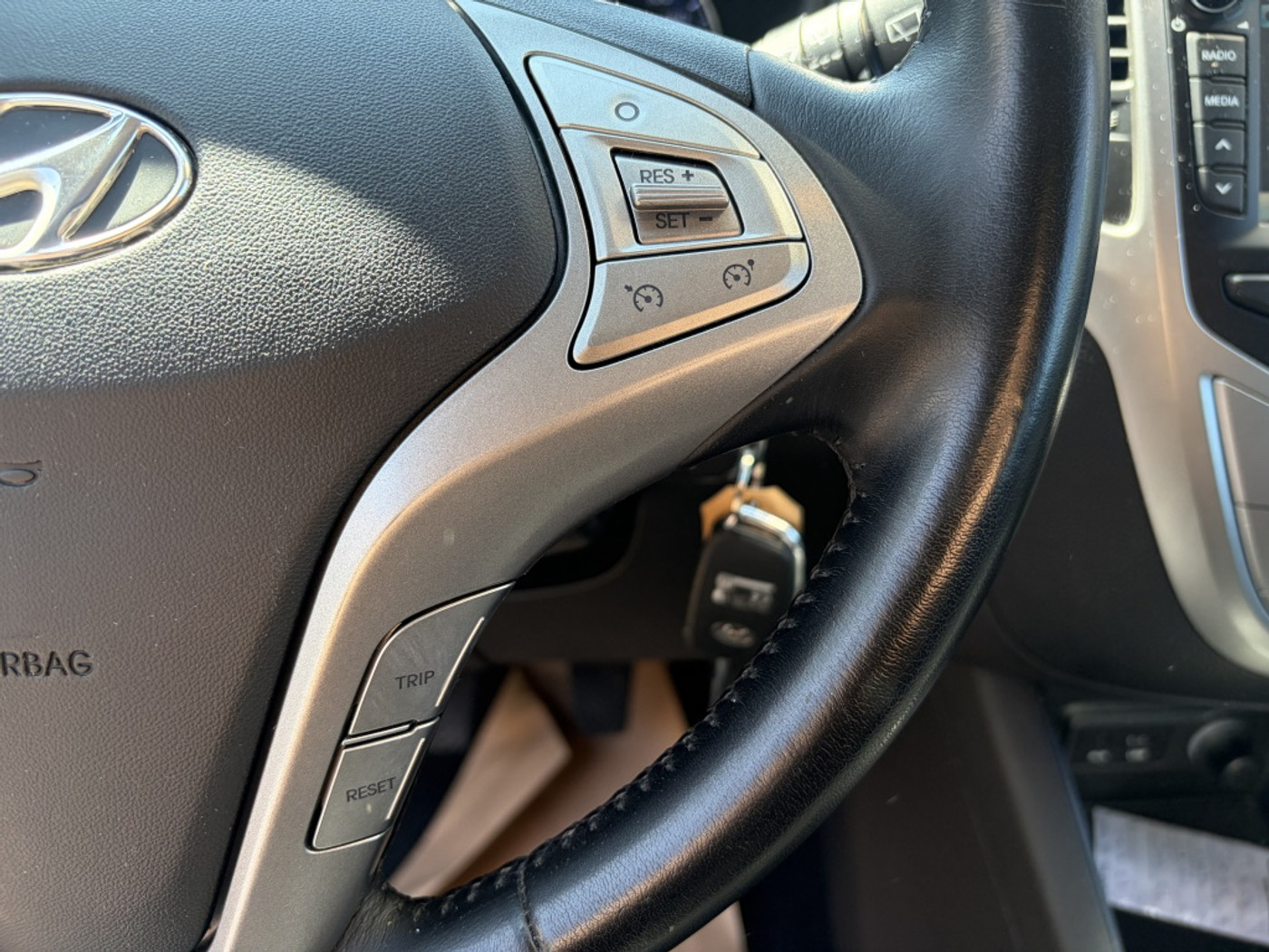 Foto van Hyundai Ix20