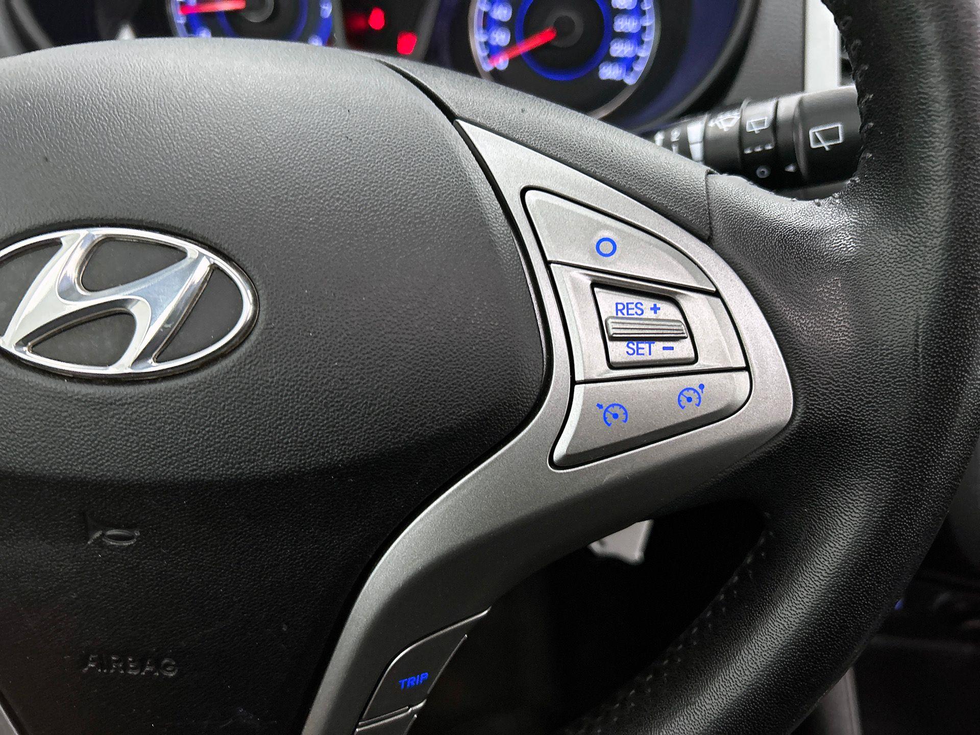 Foto van Hyundai Ix20